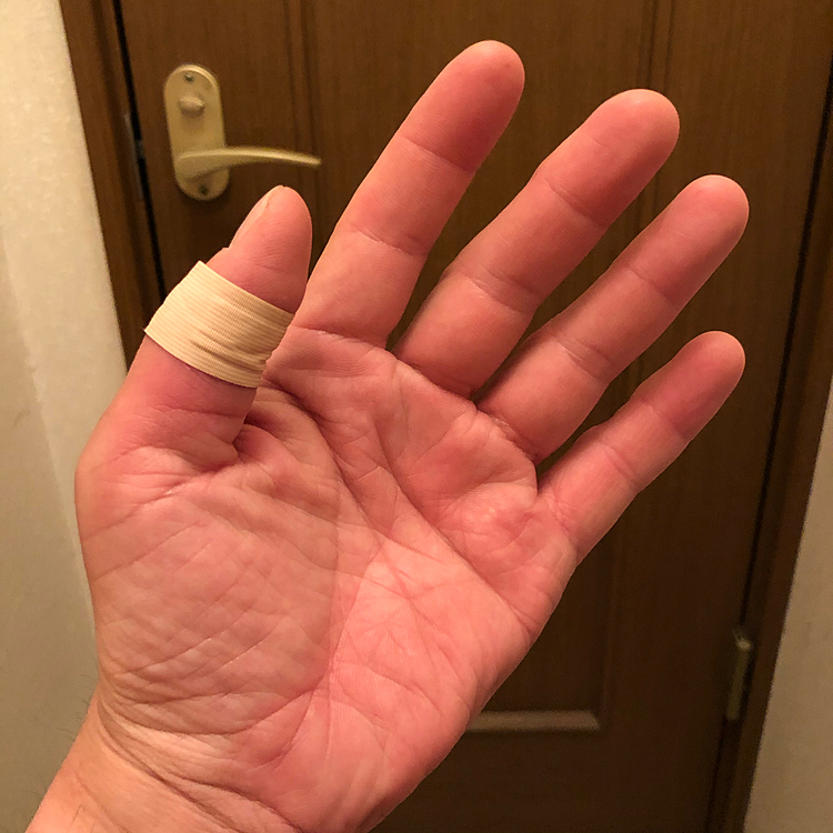昨日の噛まれた怪我ですが､今日の仕事を終えるまでやはりビリビリ痺れる感覚が抜けないので急遽外科医に直行٩(¨ )ว=͟͟͞͞
診断結果はまぁバイ菌等も見受けられないとの事で一安心☺️☺️☺️
念の為の抗生物質と傷口に塗布する軟膏を処方してもらいました💡
まぁ犬にとっては嫌なものは嫌なんだから仕方ないですが…💦💦💦