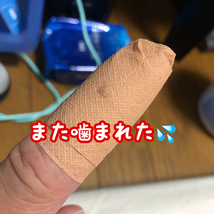 また噛まれました(T_T)
もぉ少しで歩けるって昨日お医者さんに言われたばかりなので張り切ってリハビリしようとした最中…心が折れます(-ω-;)ｳｰﾝ
