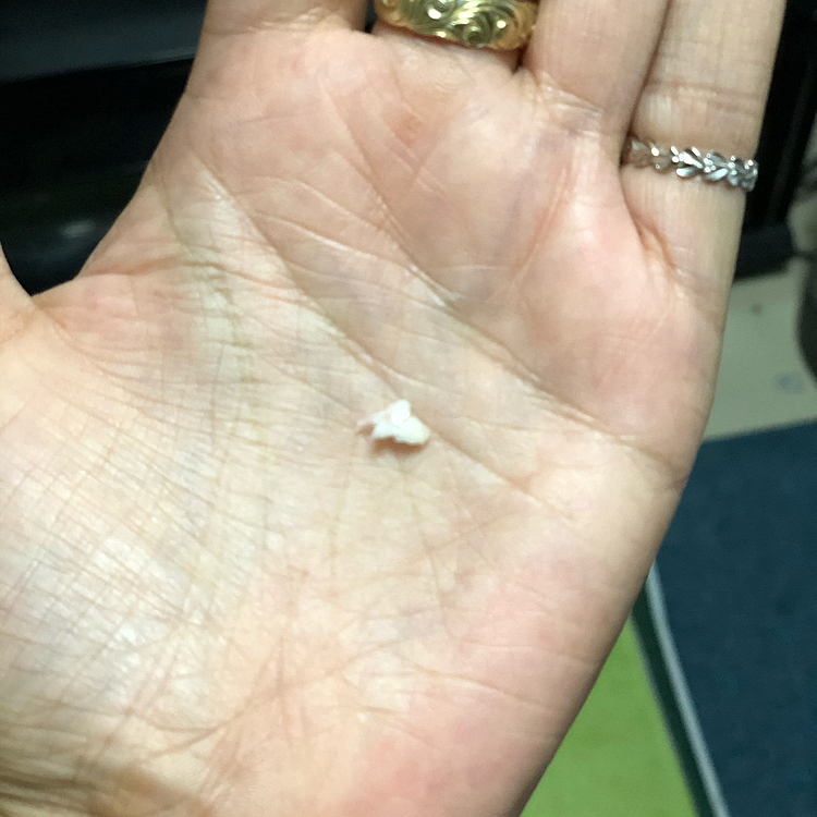 小春、昨夜また乳歯🦷が抜けたよ✨
相変わらずどこの歯かわからんッ🤣