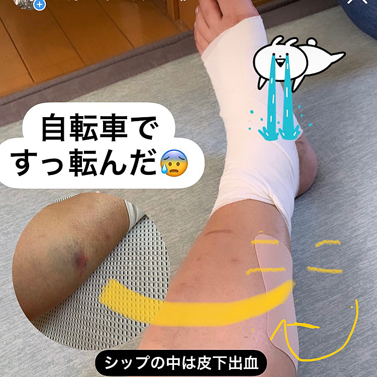 先日派手に自転車ですっ転びました🥺
一応看護師やってるので、
自ら応急処置はしたのですが、痛いのなんの。
で、痛みにもがいてたら蘭丸さんが
痛い足の所に寄り添って寝てました。
はい、癒されましたよ。ありがとう蘭丸。