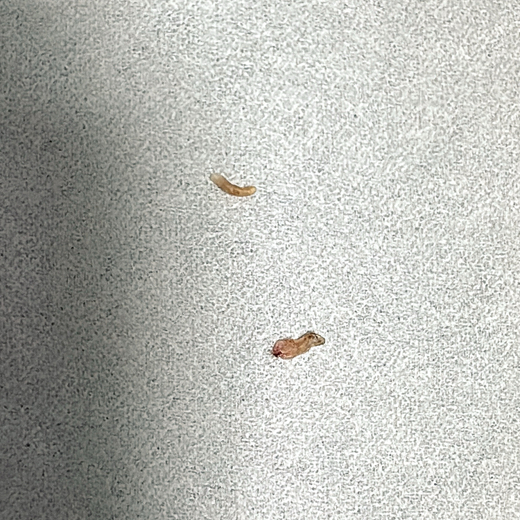 ２つ

ホントに不思議な体質です






